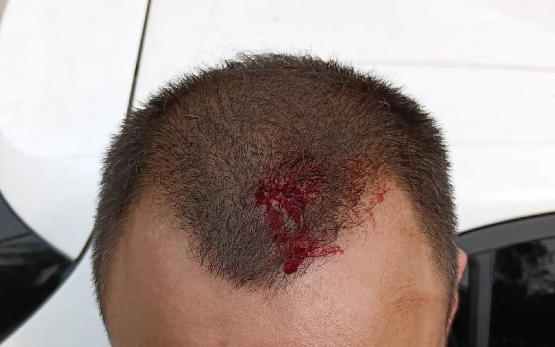 Investigação contra o tráfico termina em confusão entre policiais e moradores em São Leopoldo