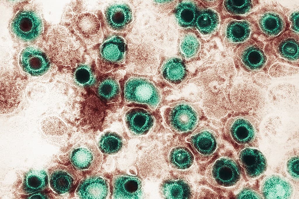 1 em cada 8 casos de câncer provavelmente é causado por infecções, diz estudo