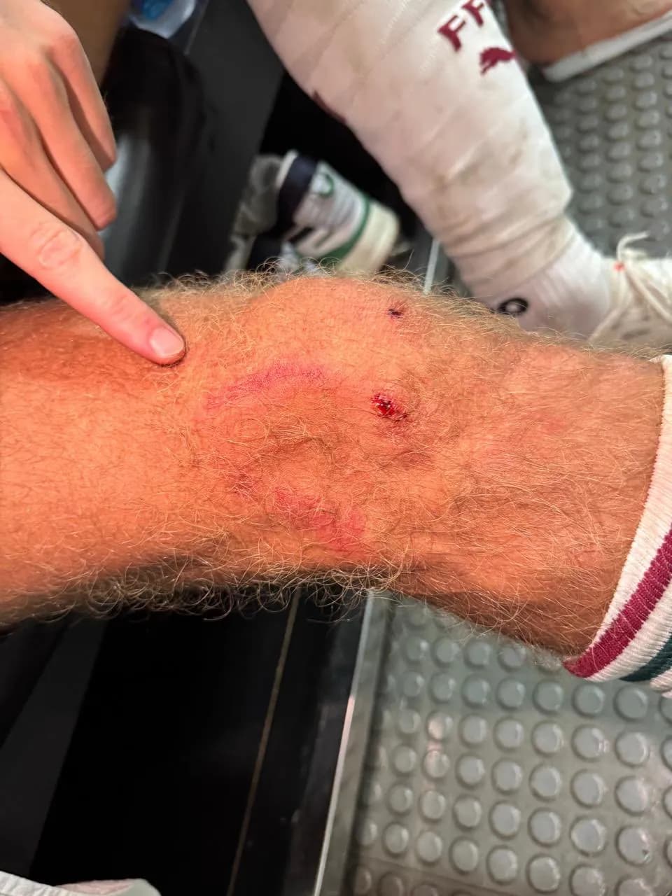 Fluminense emite nota de repúdio sobre arbitragem do Fla-Flu: “Não podemos permitir”