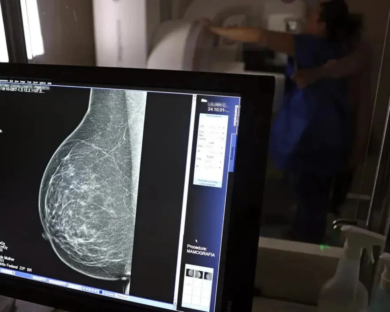 Agendamentos para mamografias serão retomados nesta terça-feira em São Leopoldo
