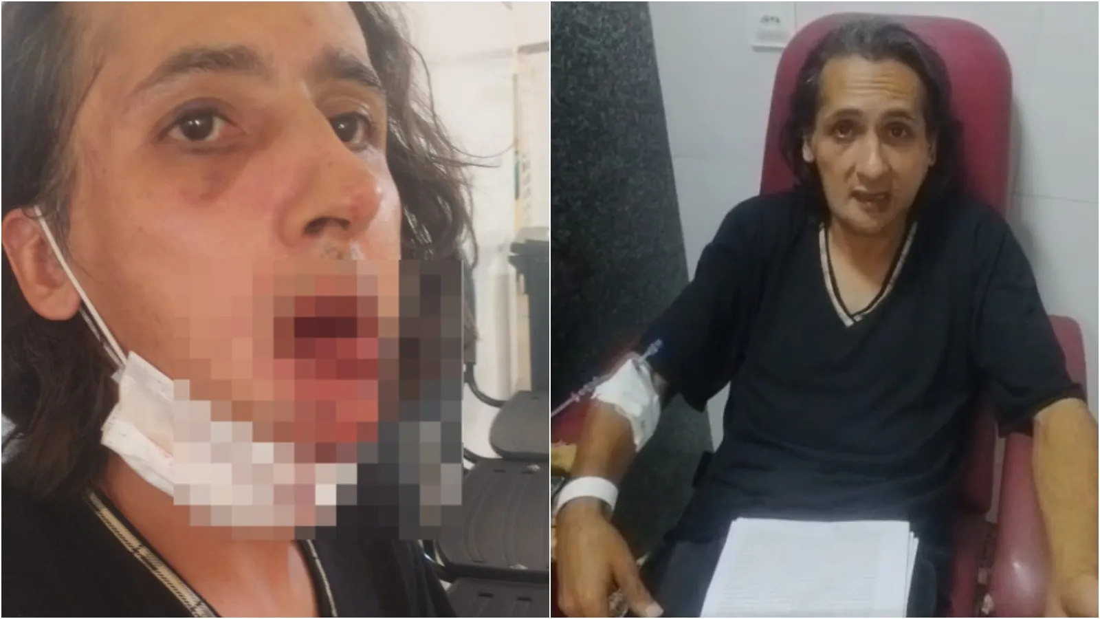 Agricultor é agredido e tem rosto fraturado após reclamar que companheiro foi impedido de usar passe-livre em van no Ceará