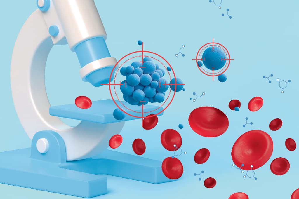 Exame de sangue pode detectar volta do câncer de mama antes das imagens
