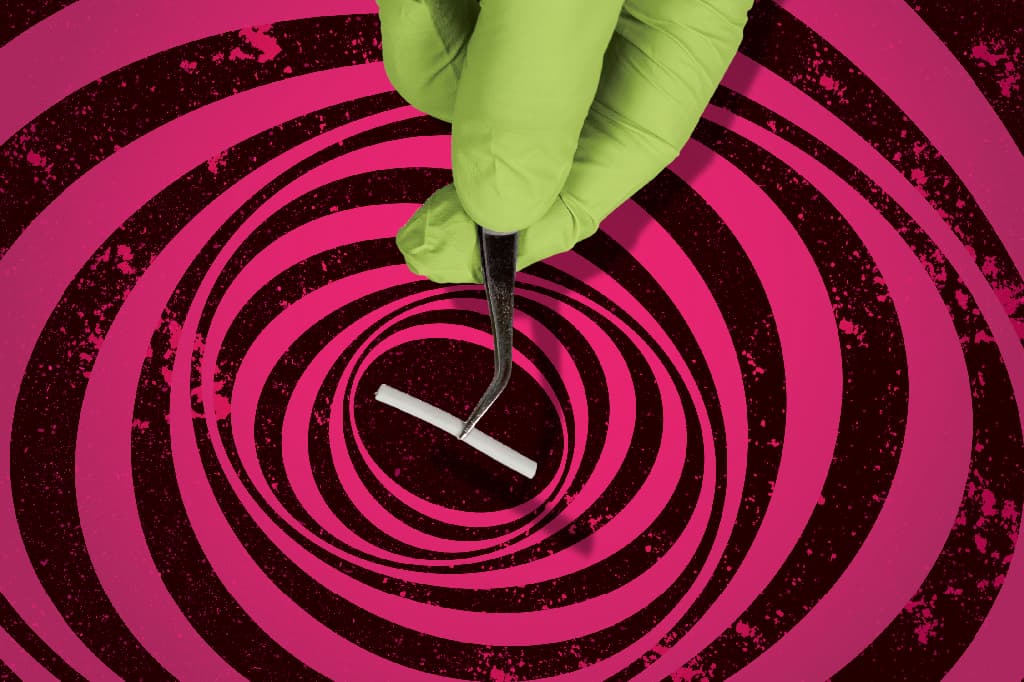 Médicos alertam contra uso de implantes hormonais manipulados na menopausa