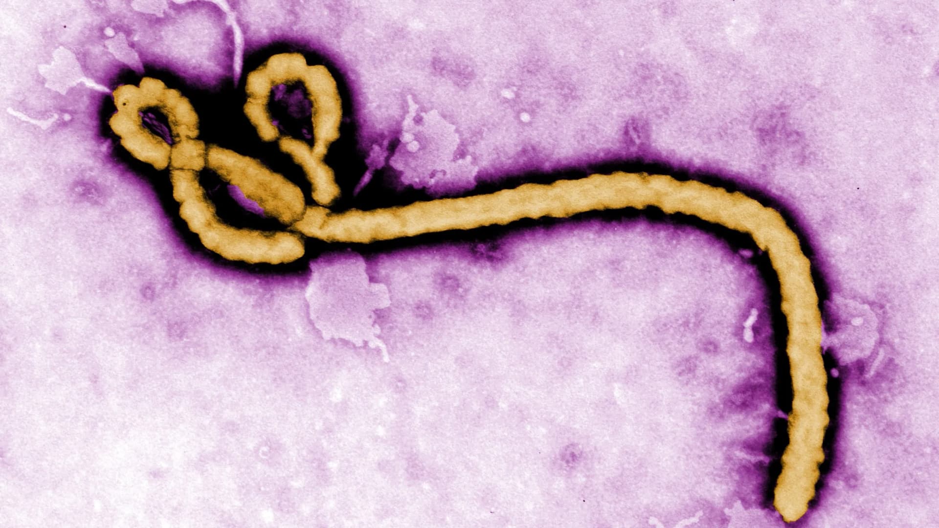 Quênia confirma primeiro caso de ebola da história do país